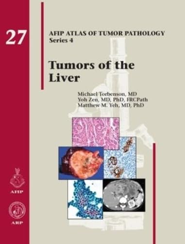 Tumors of the Liver (AFIP Atlas of Tumor Pathology, Series 4, Fascicle 27)