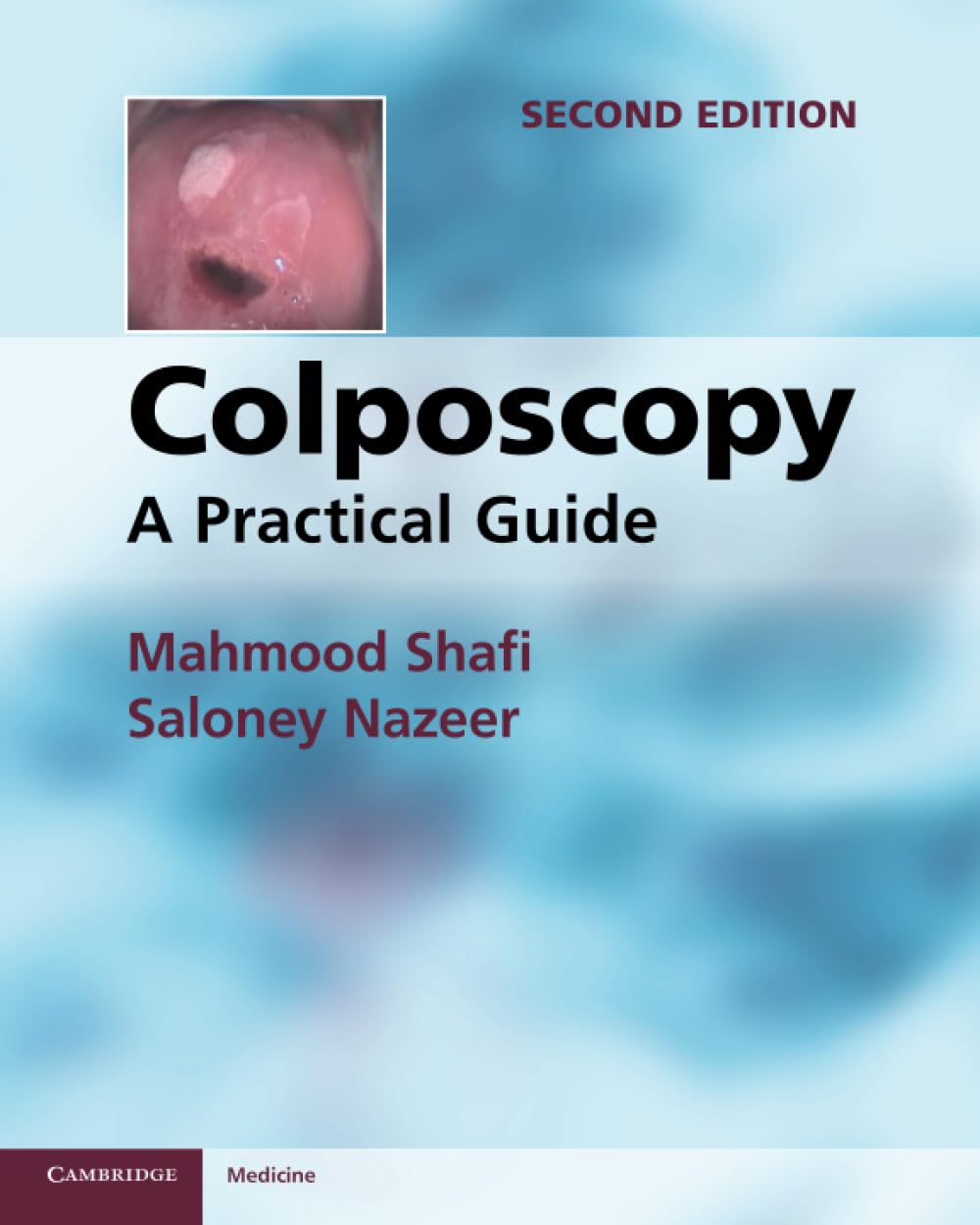 Colposcopy: A Practical Guide