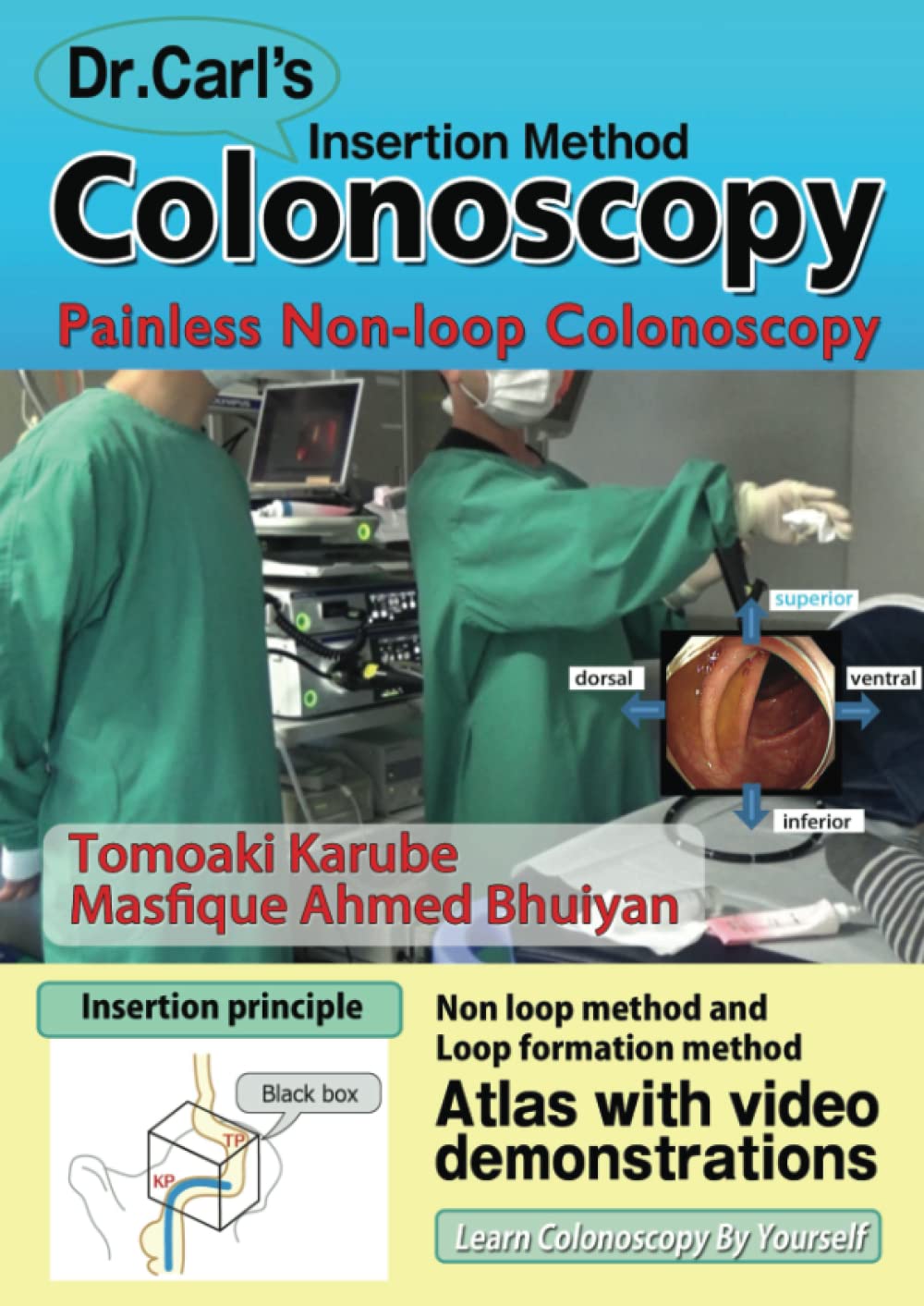 Dr. Carl’s Colonoscopy insertion method: Painless Non-loop Colonoscopy (PDF + Videos)
