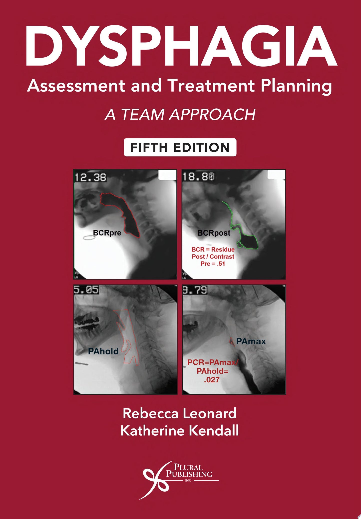 Dysphagia Assessment and Treatment Planning Workbook: A Team Approach, 5th Edition