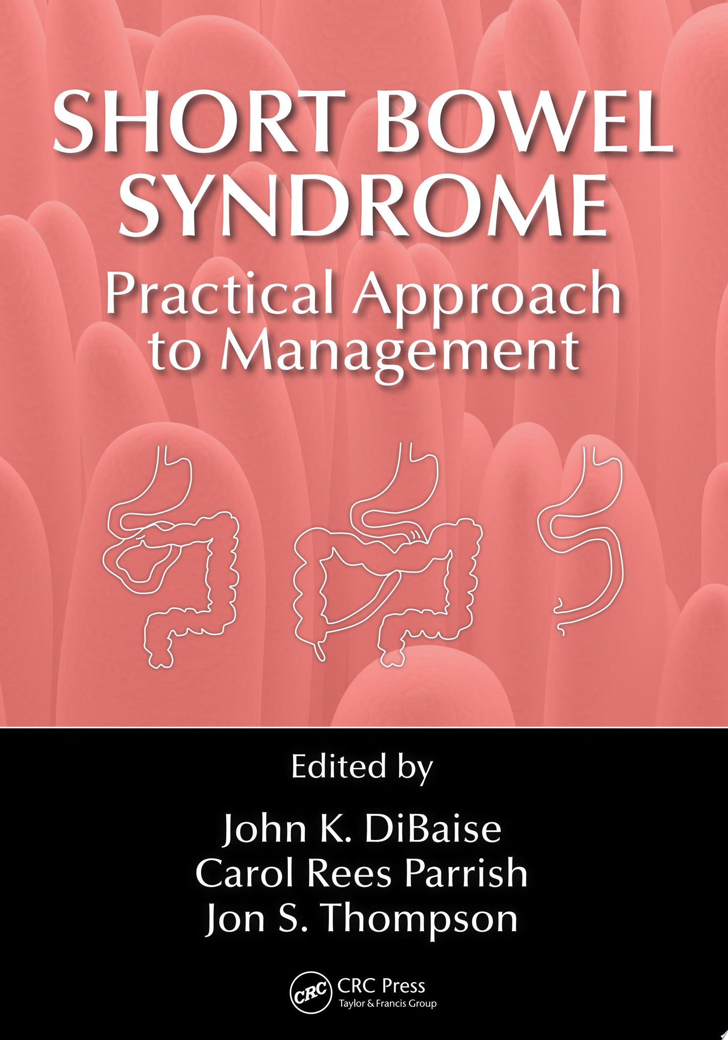 Short Bowel Syndrome: Practical Approach to Management