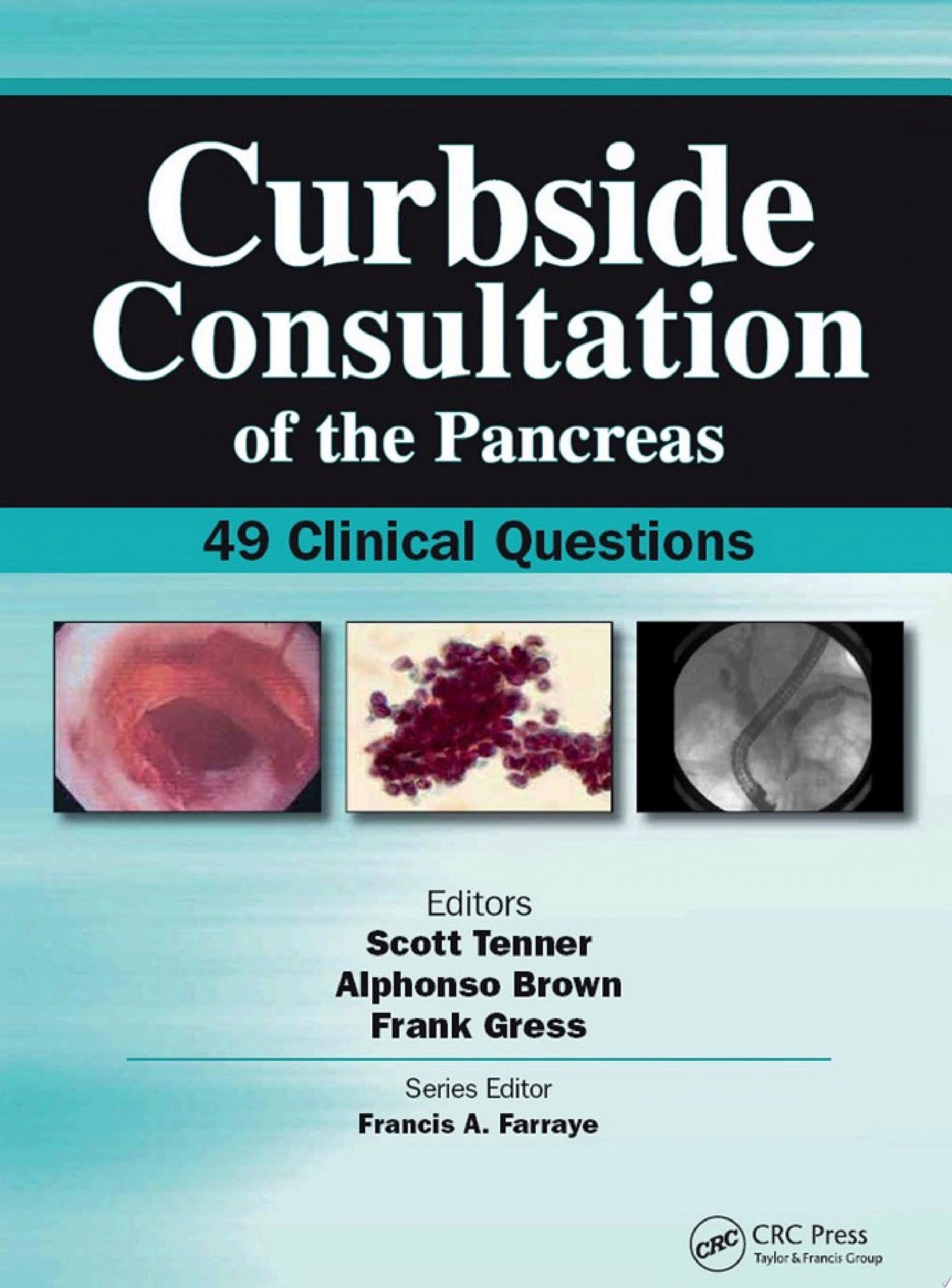 Curbside Consultation of the Pancreas: 49 Clinical Questions