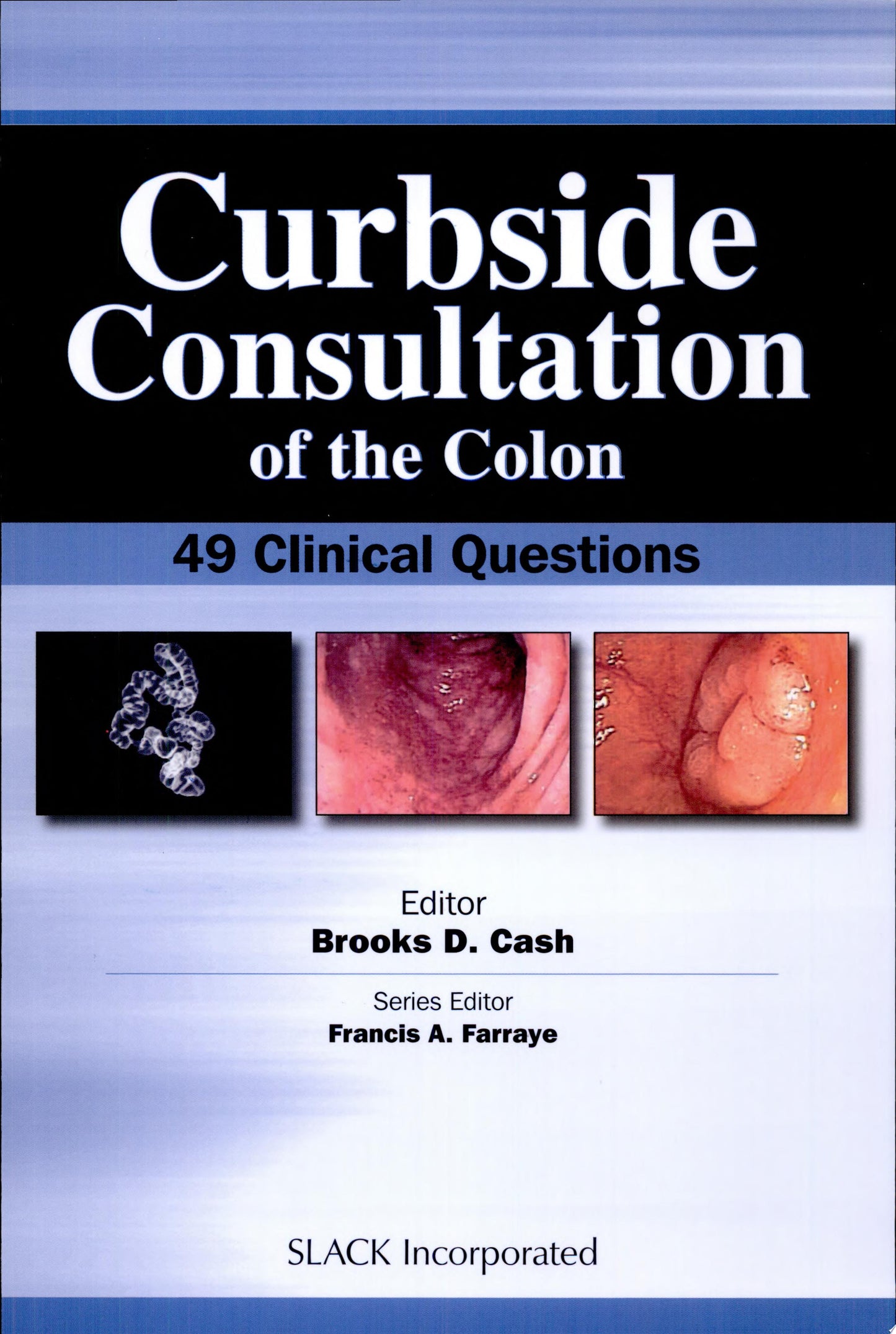 Curbside Consultation in GERD: 49 Clinical Questions