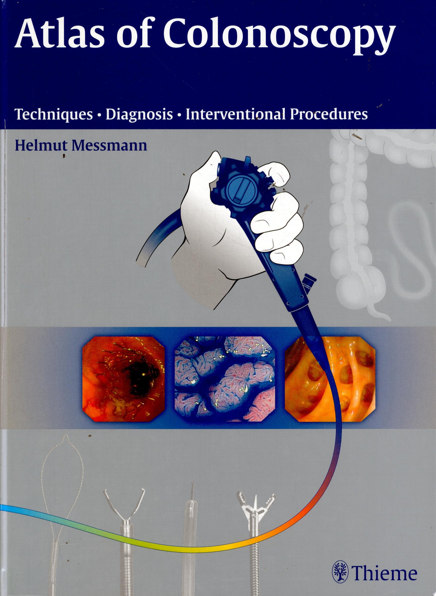 Atlas of Colonoscopy: Examination Techniques and Diagnosis