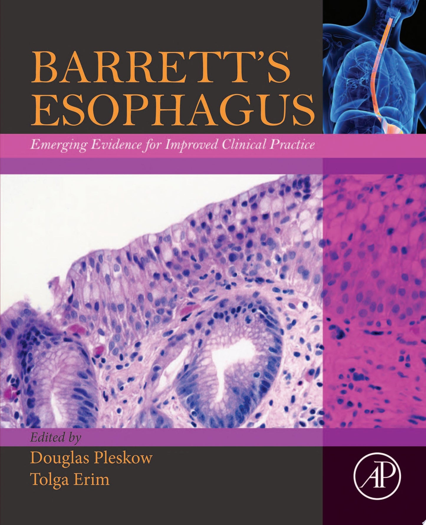 Barrett’s Esophagus: Emerging Evidence for Improved Clinical Practice