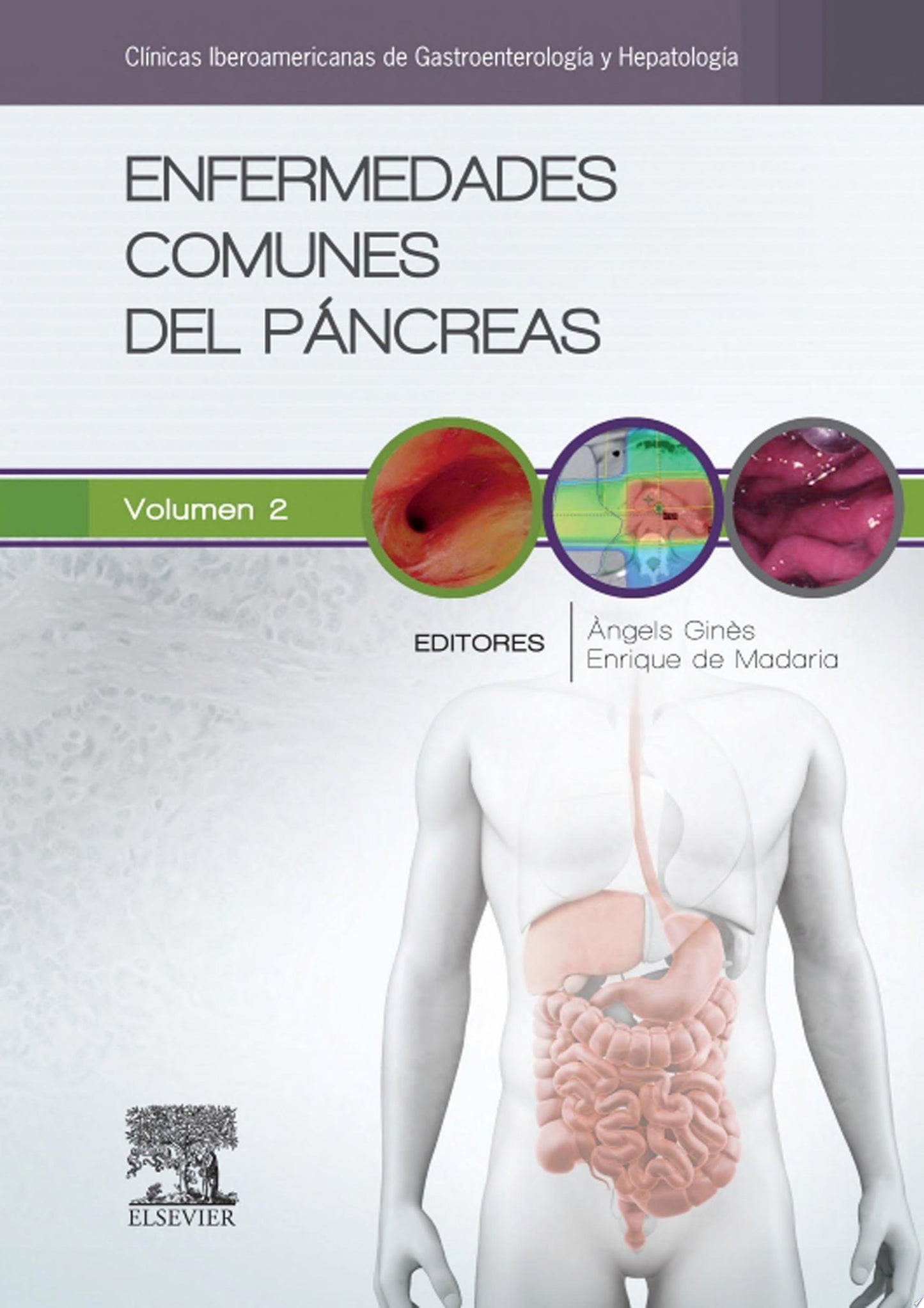 Enfermedades comunes del páncreas