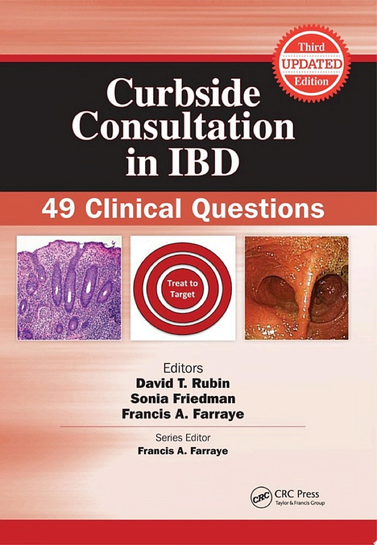 Curbside Consultation in IBD: 49 Clinical Questions