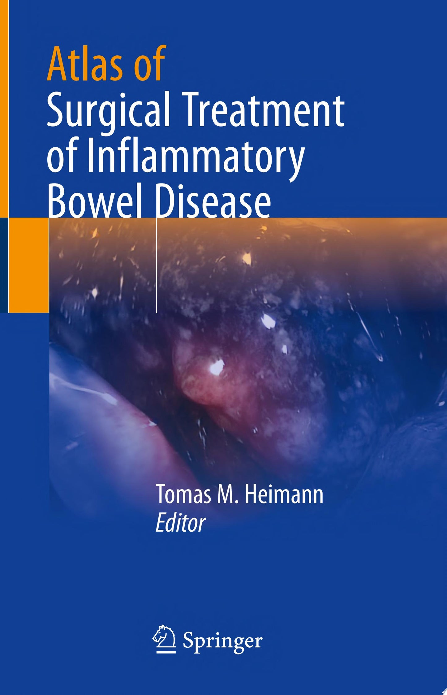 Atlas of Surgical Treatment of Inflammatory Bowel Disease