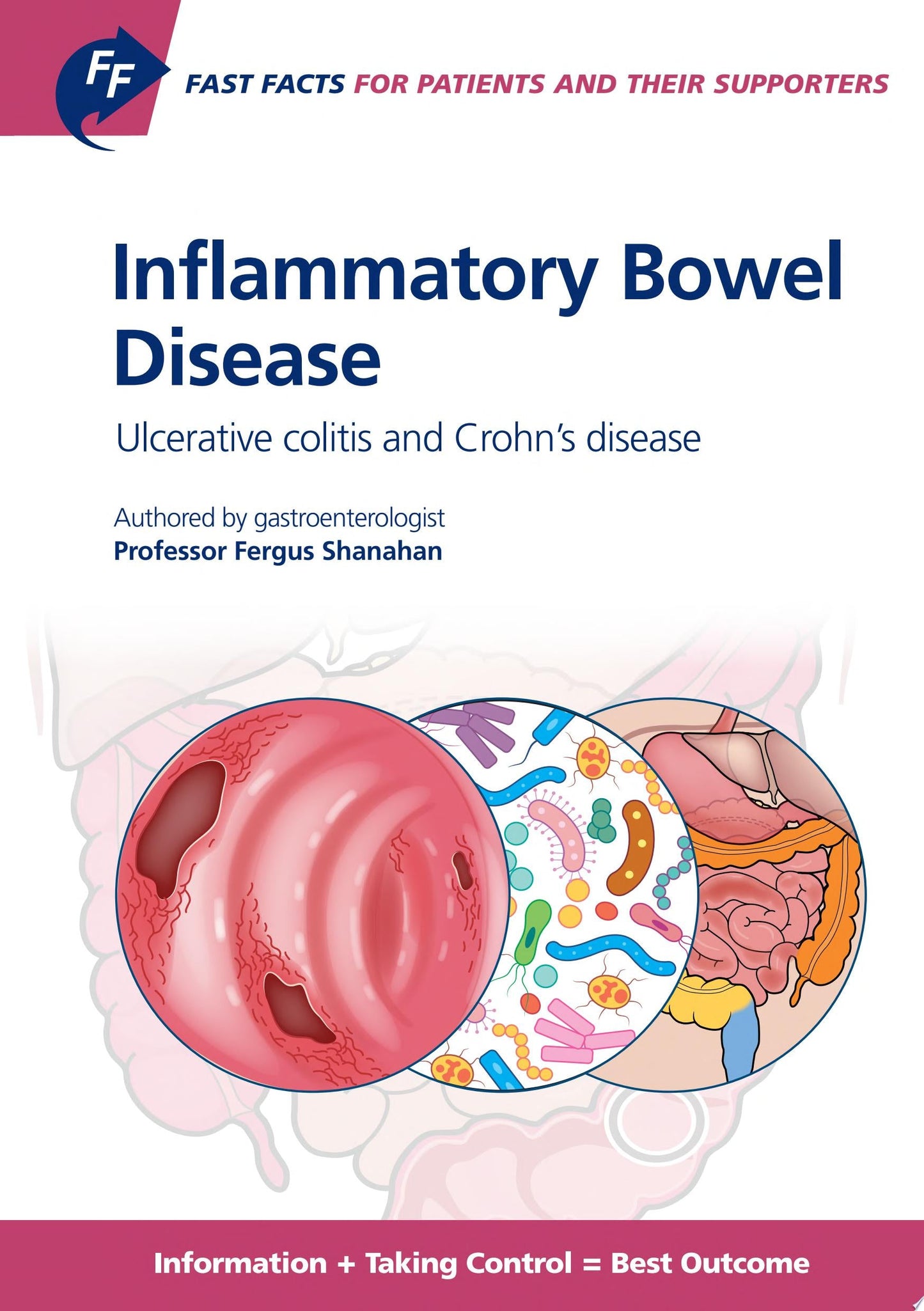 Inflammatory Bowel Disease for Patients and Their Supporters: Ulcerative Colitis and Crohn s Disease