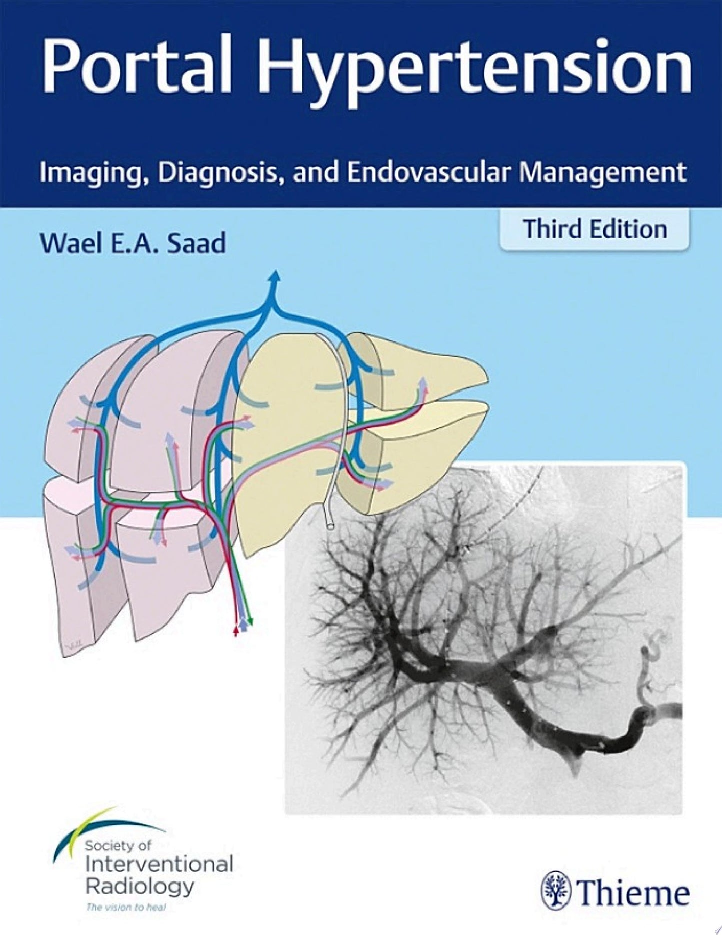 Portal Hypertension: Imaging, Diagnosis, and Endovascular Management, 3rd Edition
