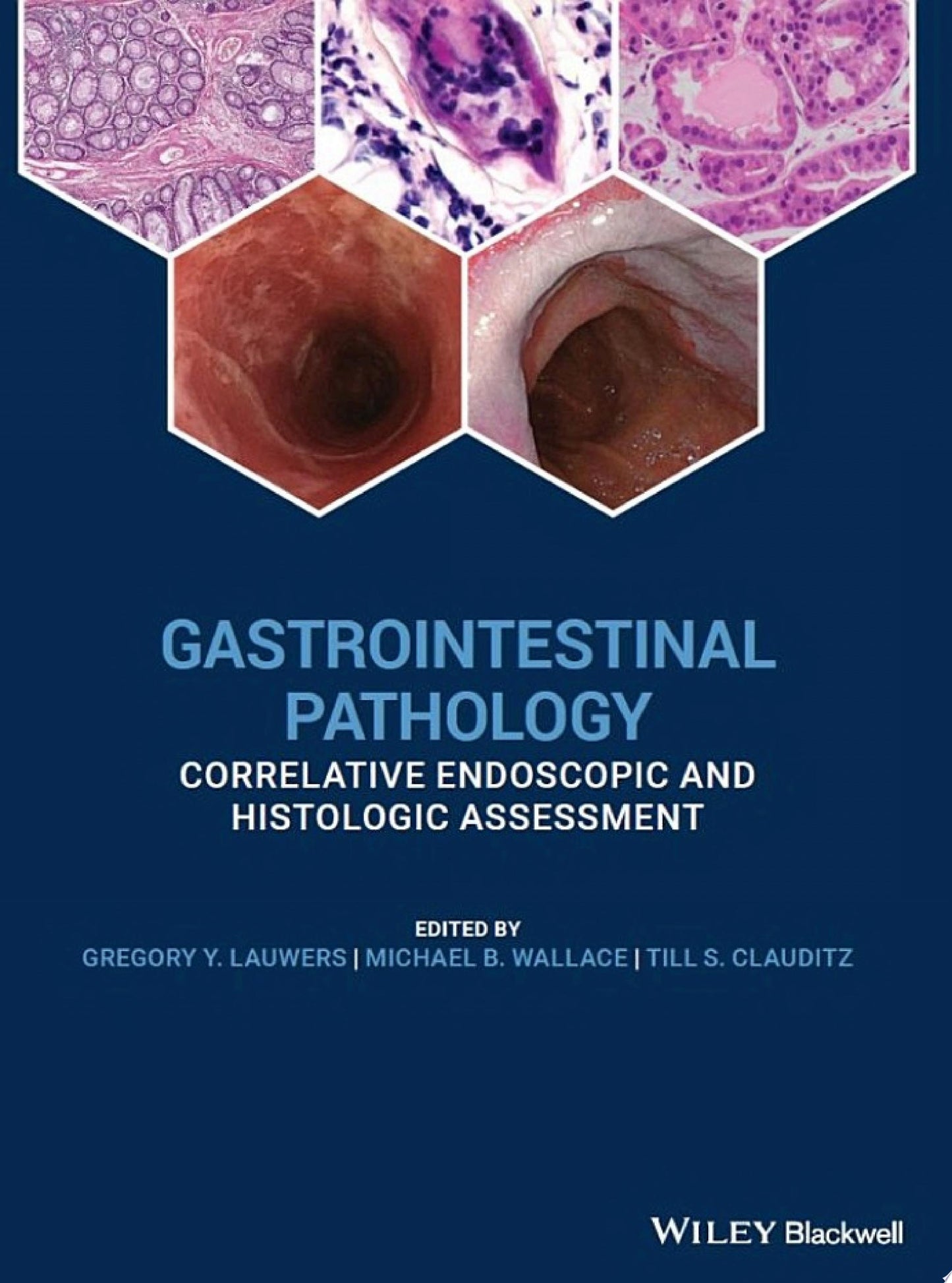 Gastrointestinal Pathology: Correlative Endoscopic and Histologic Assessment