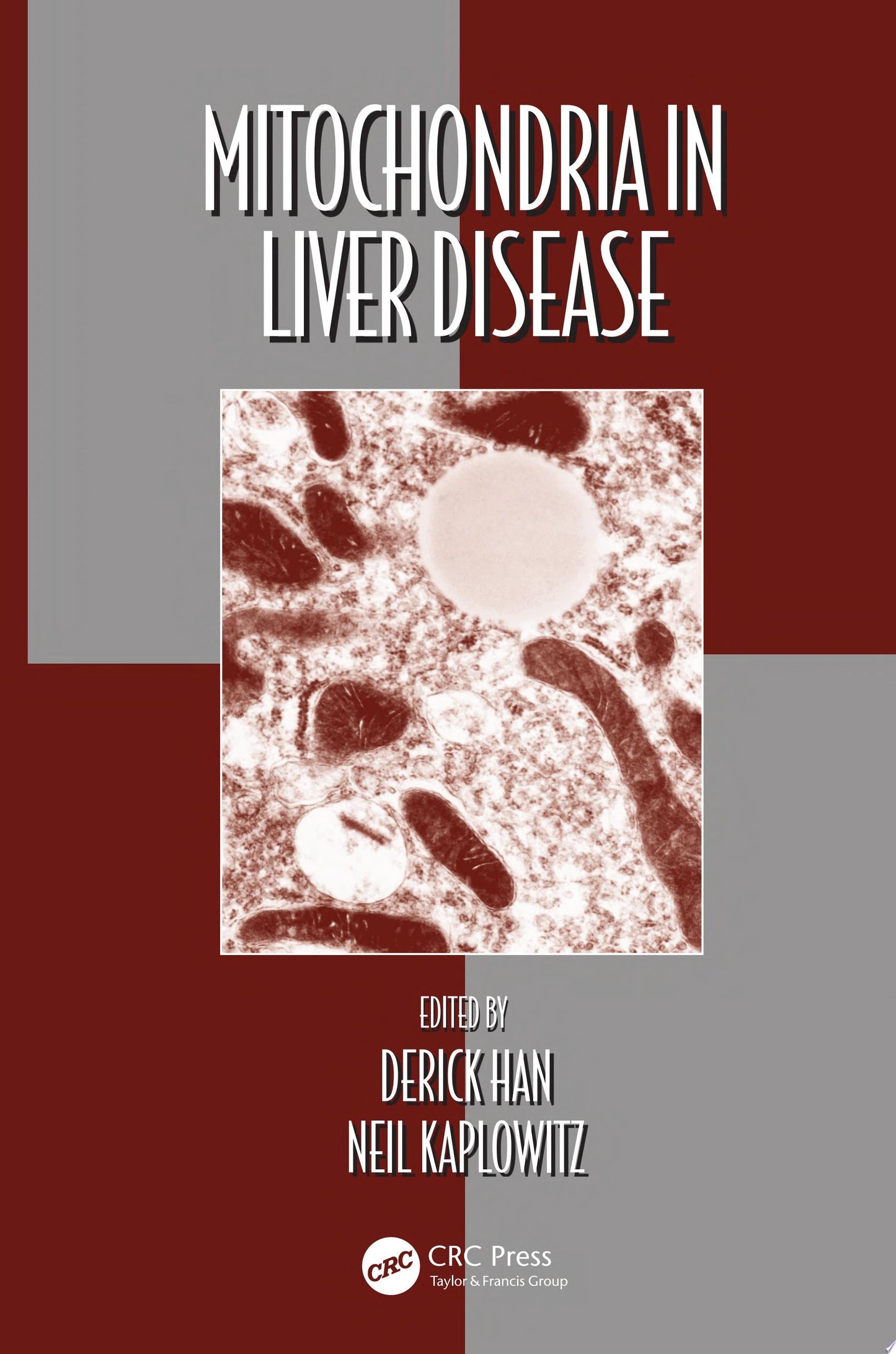 Mitochondria in Liver Disease