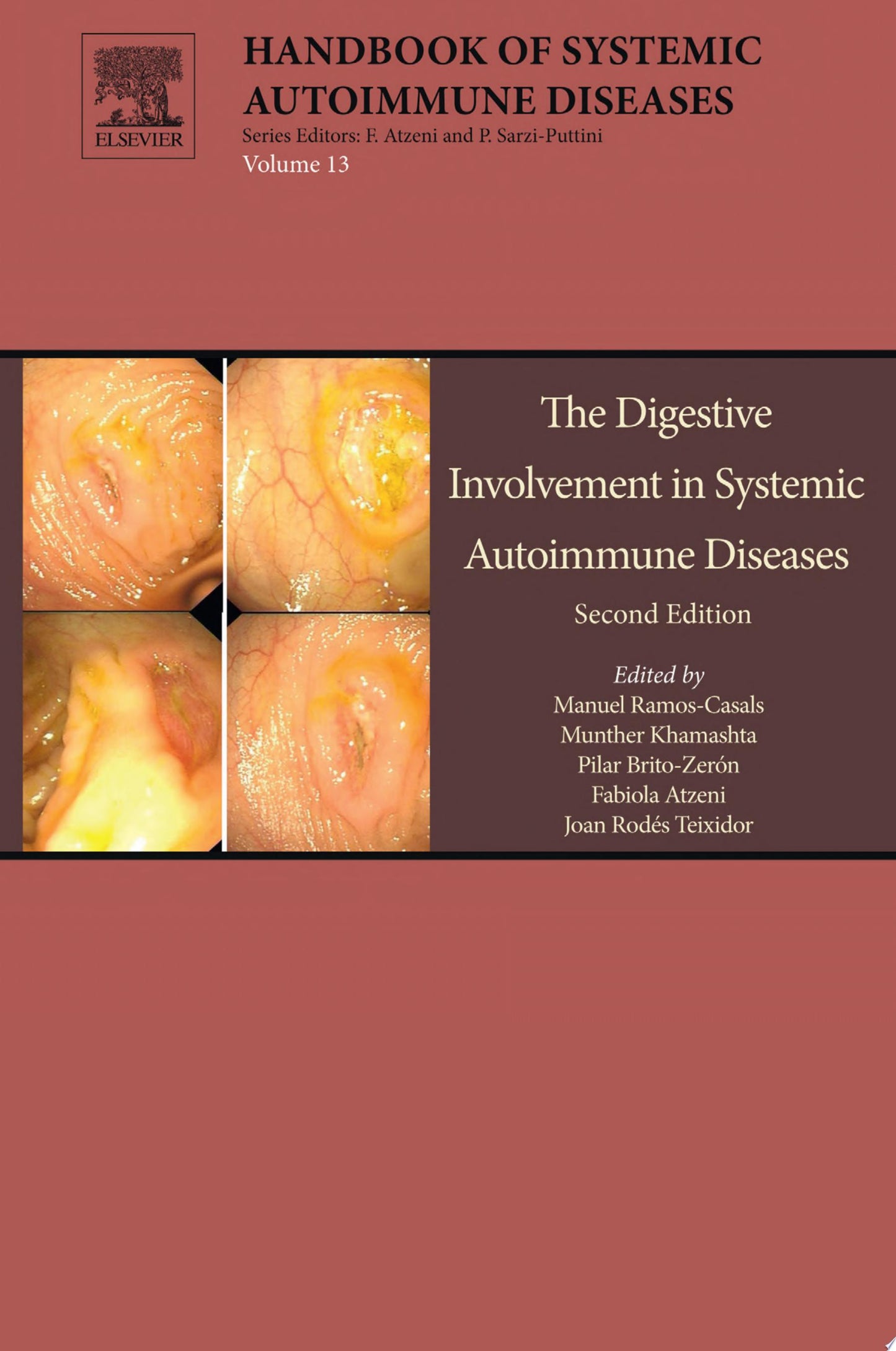 The Digestive Involvement in Systemic Autoimmune Diseases, Volume 13, Second Edition