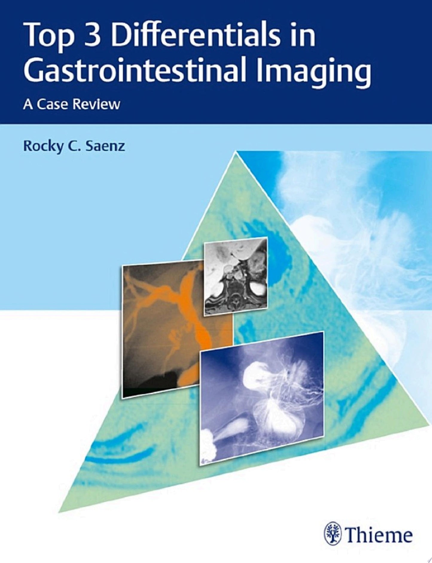 Top 3 Differentials in Gastrointestinal Imaging: A Case Review