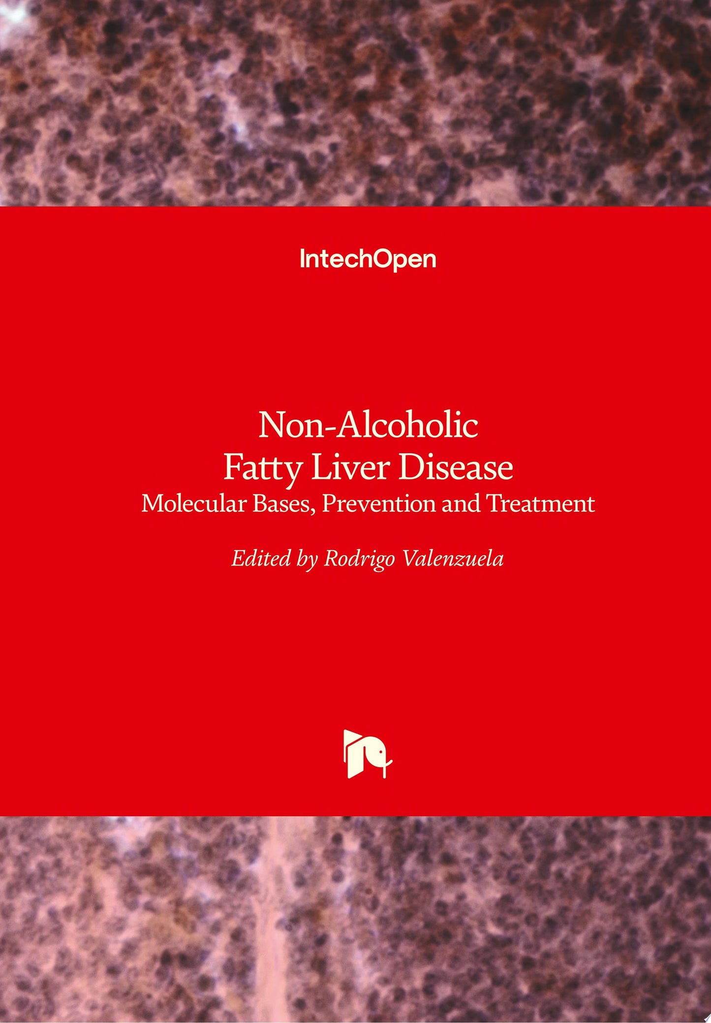 Nonalcoholic Fatty Liver Disease