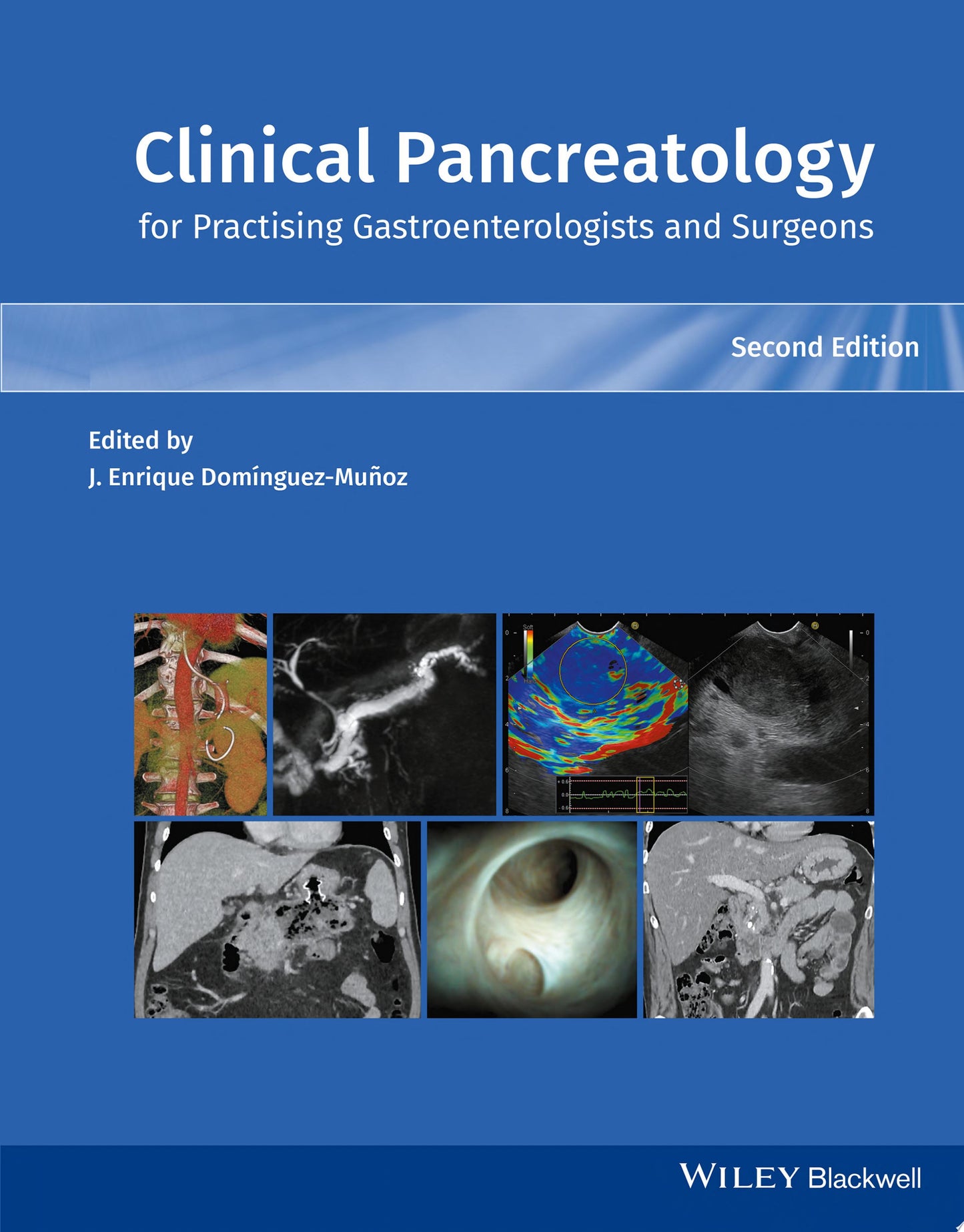 Clinical Pancreatology for Practising Gastroenterologists and Surgeons, 2nd Edition