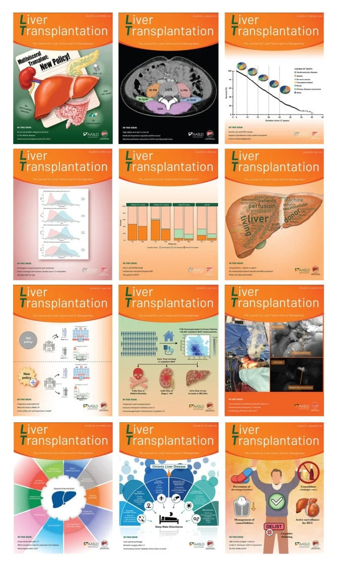Liver Transplantation 2024 Full Archives