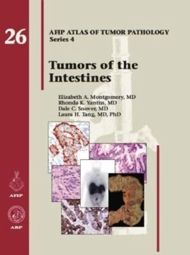 Tumors of the Intestines (AFIP Atlas of Tumor Pathology, Series 4, Fascicle 26)