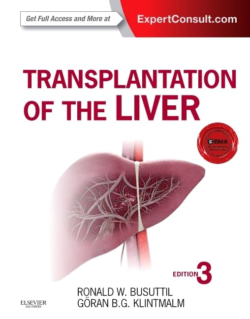 Transplantation of the Liver, 3rd Edition