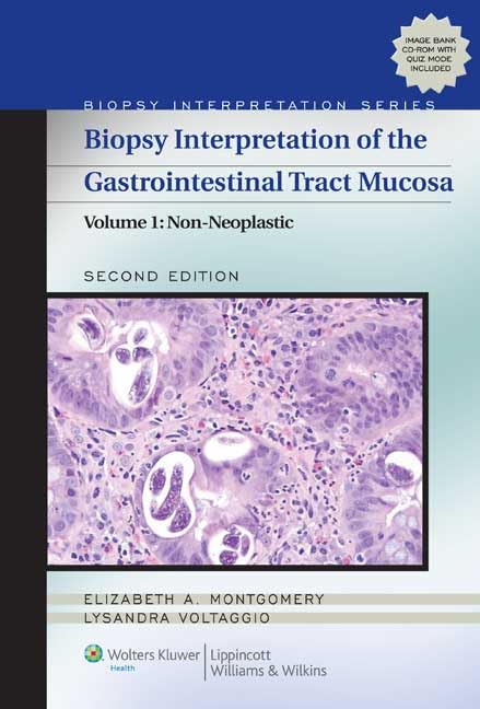 Biopsy Interpretation of the Gastrointestinal Tract Mucosa: Volume 1: Non-Neoplastic, 2nd Edition