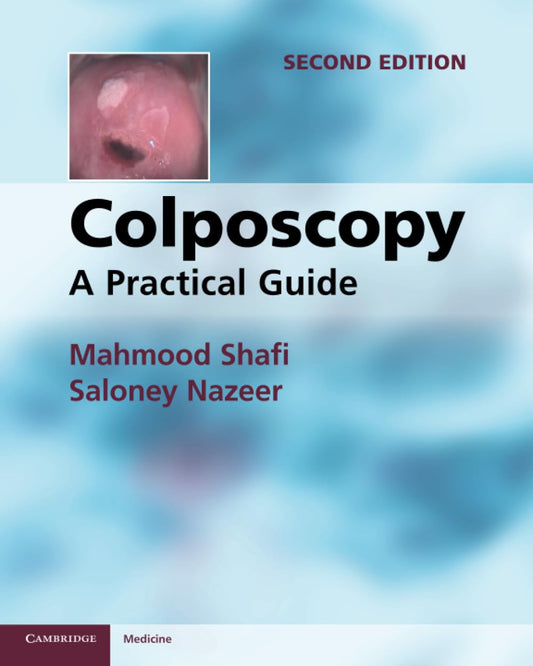 Colposcopy: A Practical Guide