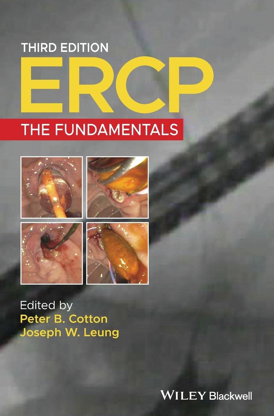 ERCP: The Fundamentals, 2e