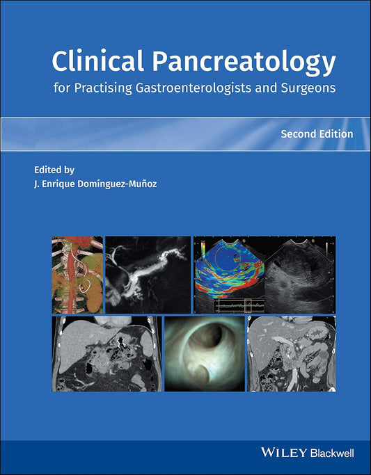Clinical Pancreatology for Practicing Gastroenterologists and Surgeons, 2nd Edition