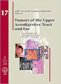Tumors of the Upper Aerodigestive Tract and Ear (AFIP Atlas of Tumor Pathology, Series 4, Fascicle 17)