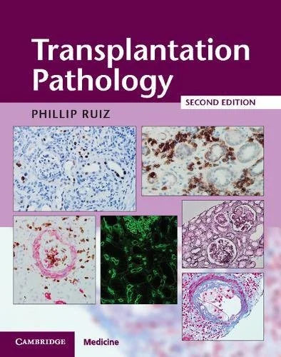 Transplantation Pathology, 2nd Edition