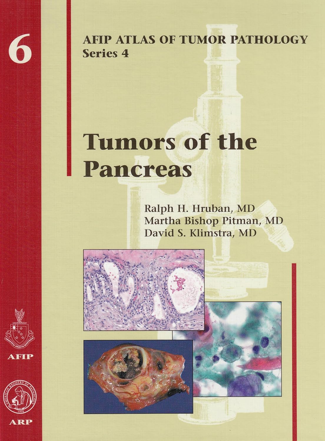 Tumors of the Pancreas