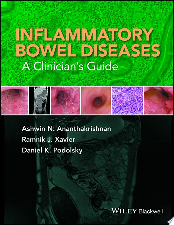 Inflammatory Bowel Disease