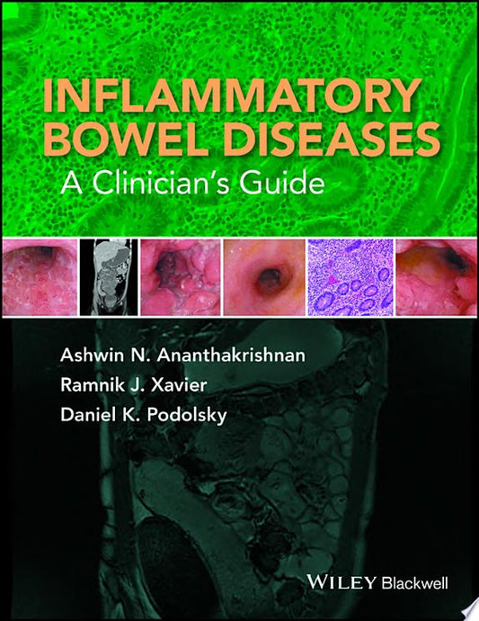 Inflammatory Bowel Disease