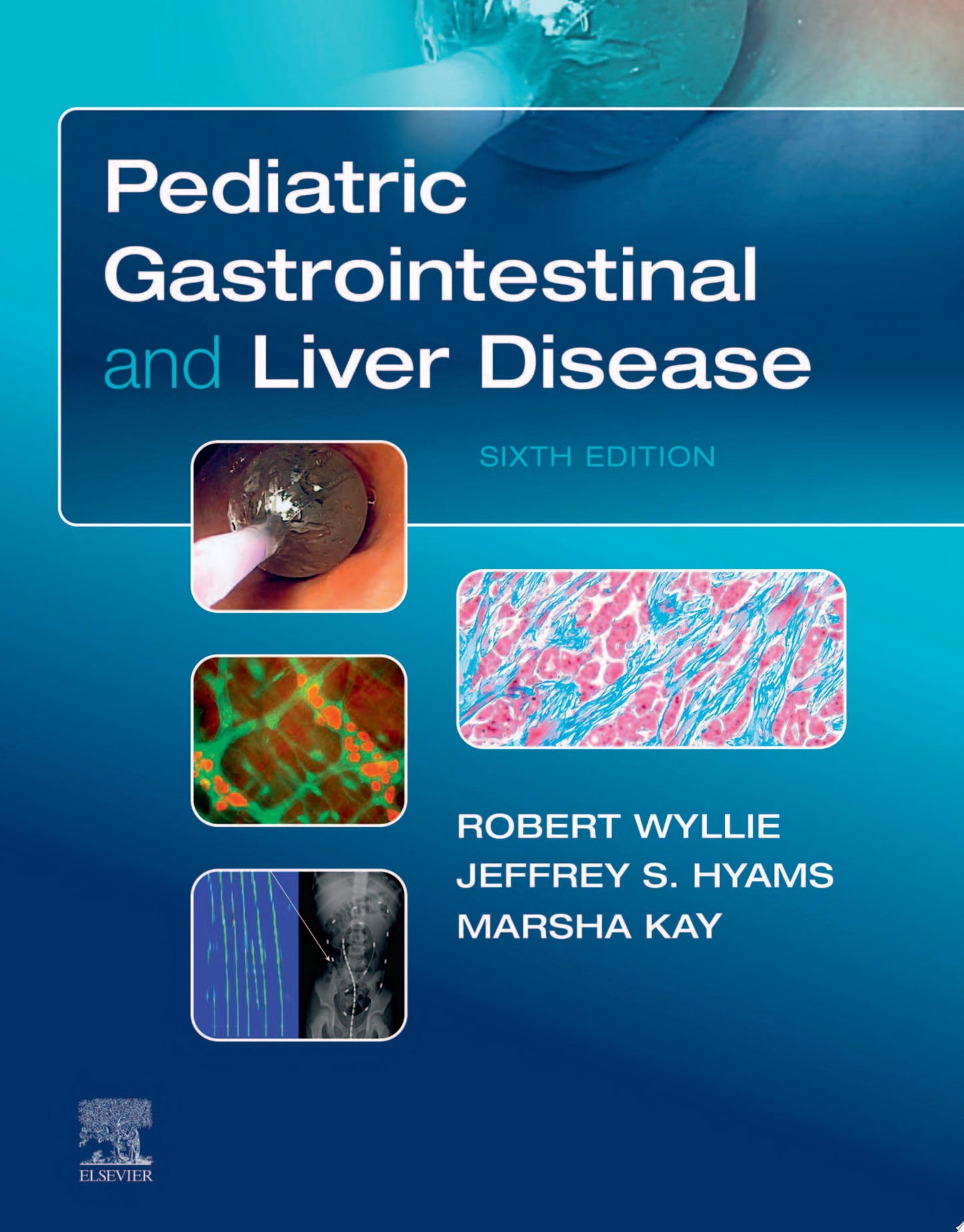 Pediatric Gastrointestinal and Liver Disease 6th Edition