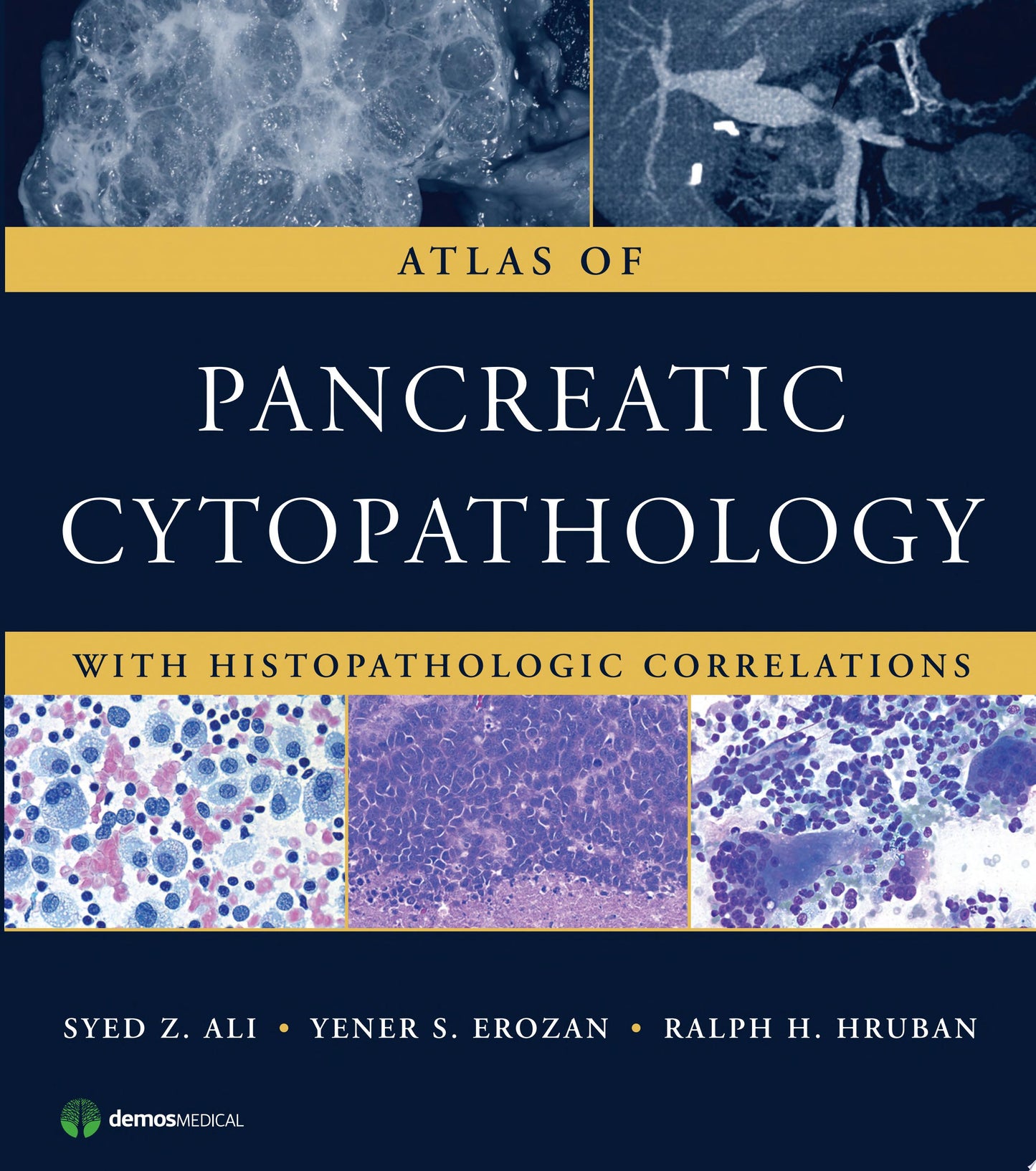Atlas of Pancreatic Cytopathology with Histopathologic Correlations