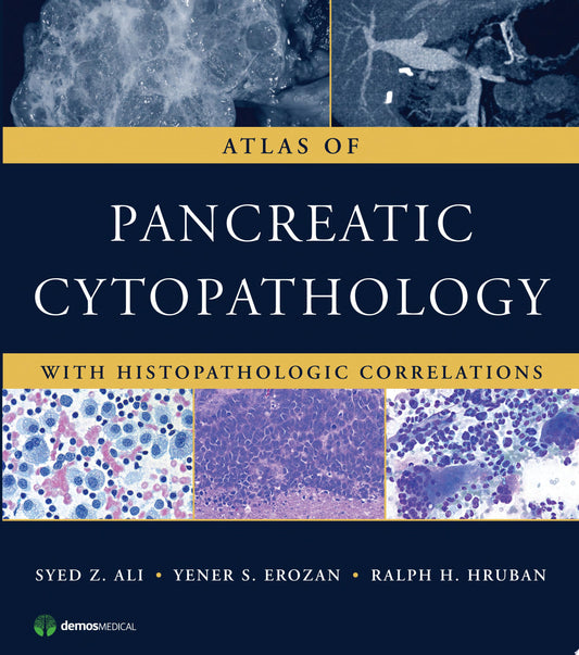 Atlas of Pancreatic Cytopathology with Histopathologic Correlations