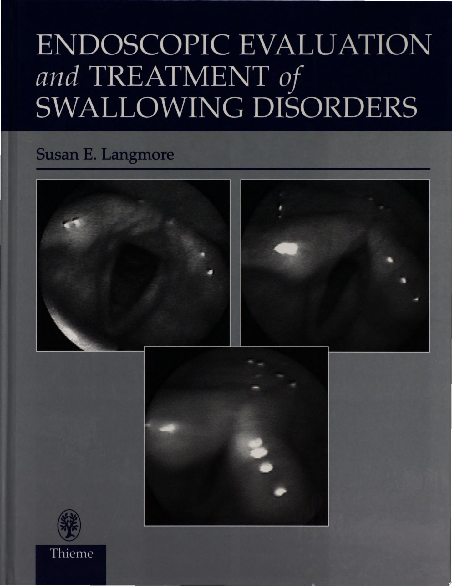Endoscopic Evaluation and Treatment of Swallowing Disorders