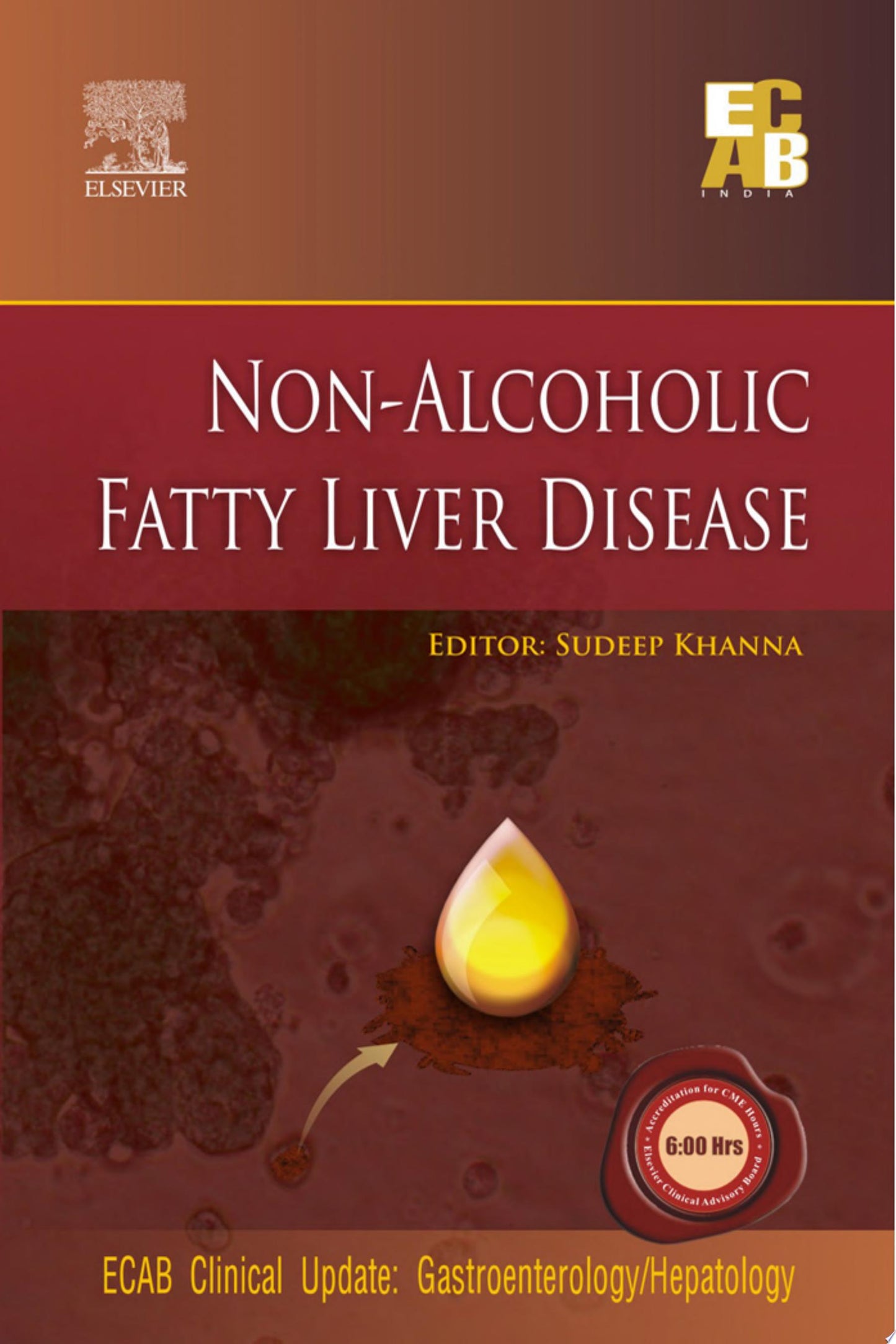 Non-Alcoholic Fatty Liver Disease – ECAB