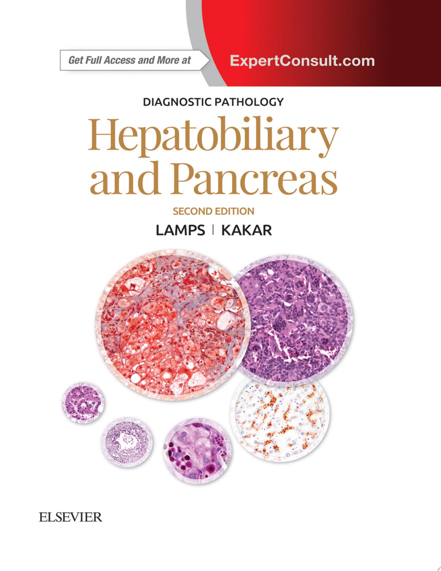 Diagnostic Pathology: Hepatobiliary and Pancreas E-Book, 2nd Edition