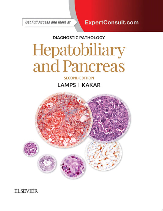 Diagnostic Pathology: Hepatobiliary and Pancreas E-Book, 2nd Edition