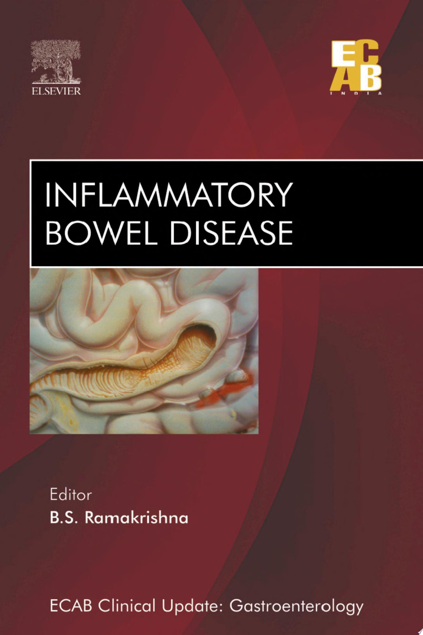 Inflammatory Bowel Diseases – ECAB