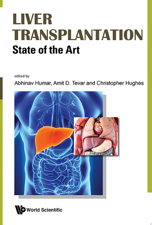 Liver Transplantation: State of the Art