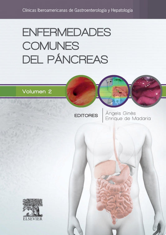 Enfermedades comunes del páncreas