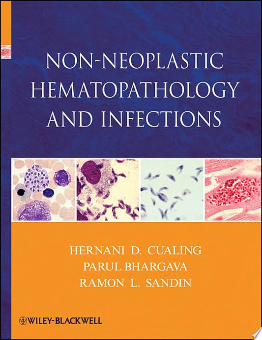 Non-Neoplastic Hematopathology and Infections