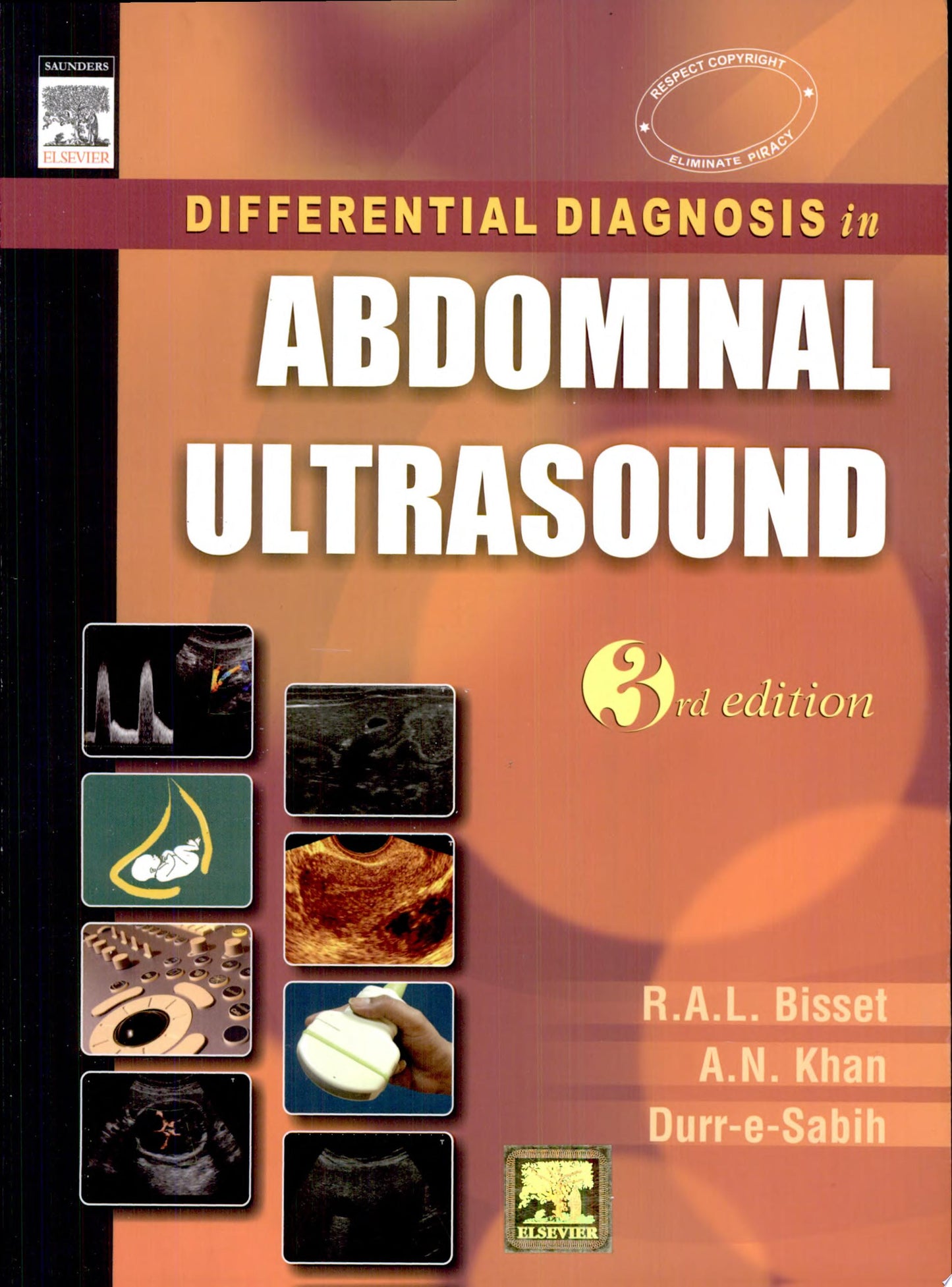 Abdominal Ultrasound: How, Why and When, 3rd
