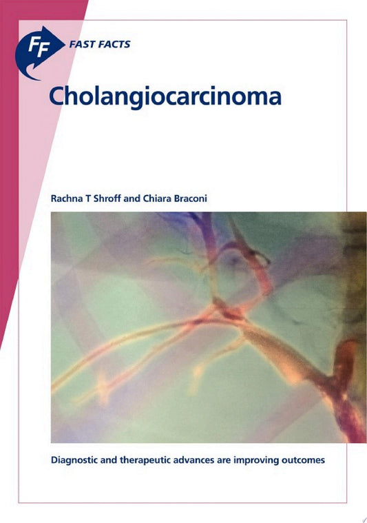 Fast Facts: Cholangiocarcinoma: Diagnostic and Therapeutic Advances Are Improving Outcomes