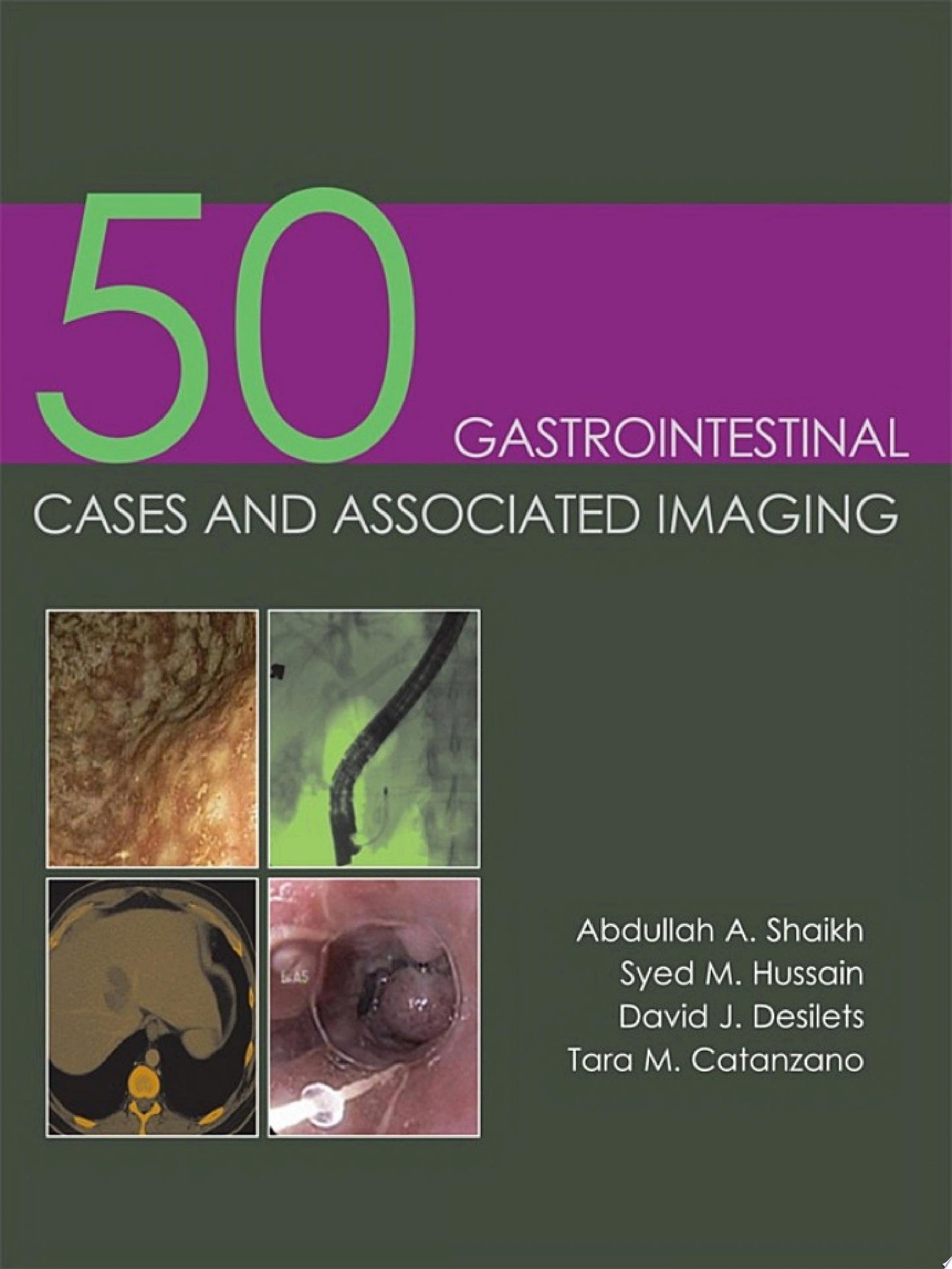 50 Gastrointestinal Cases and Associated Imaging
