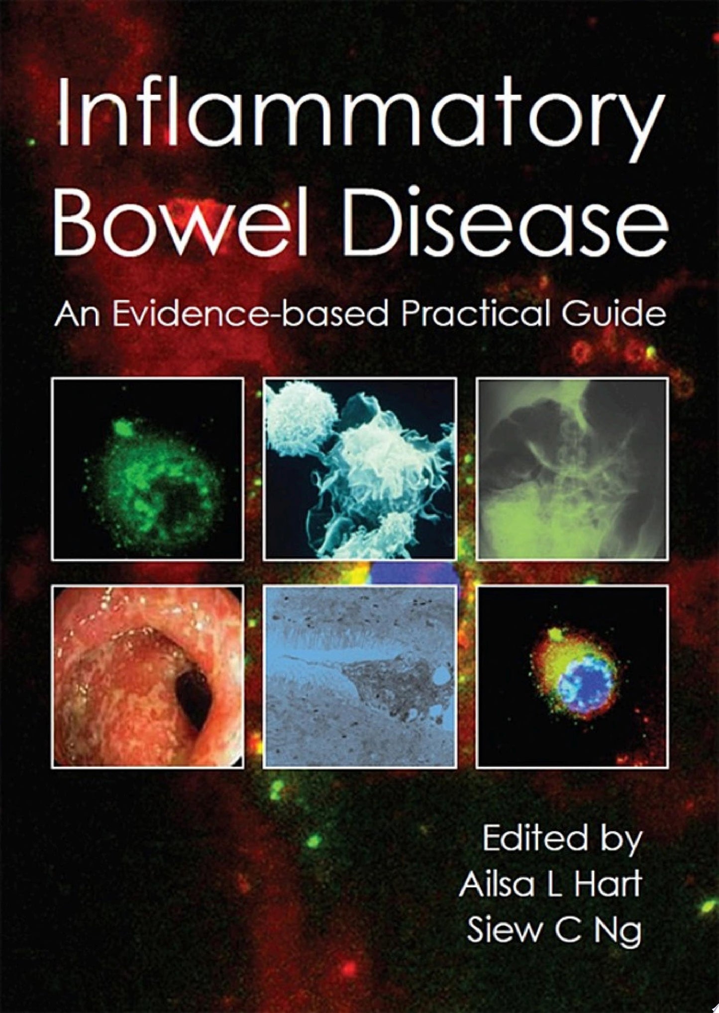 Inflammatory Bowel Disease: An Evidence-Based Practical Guide
