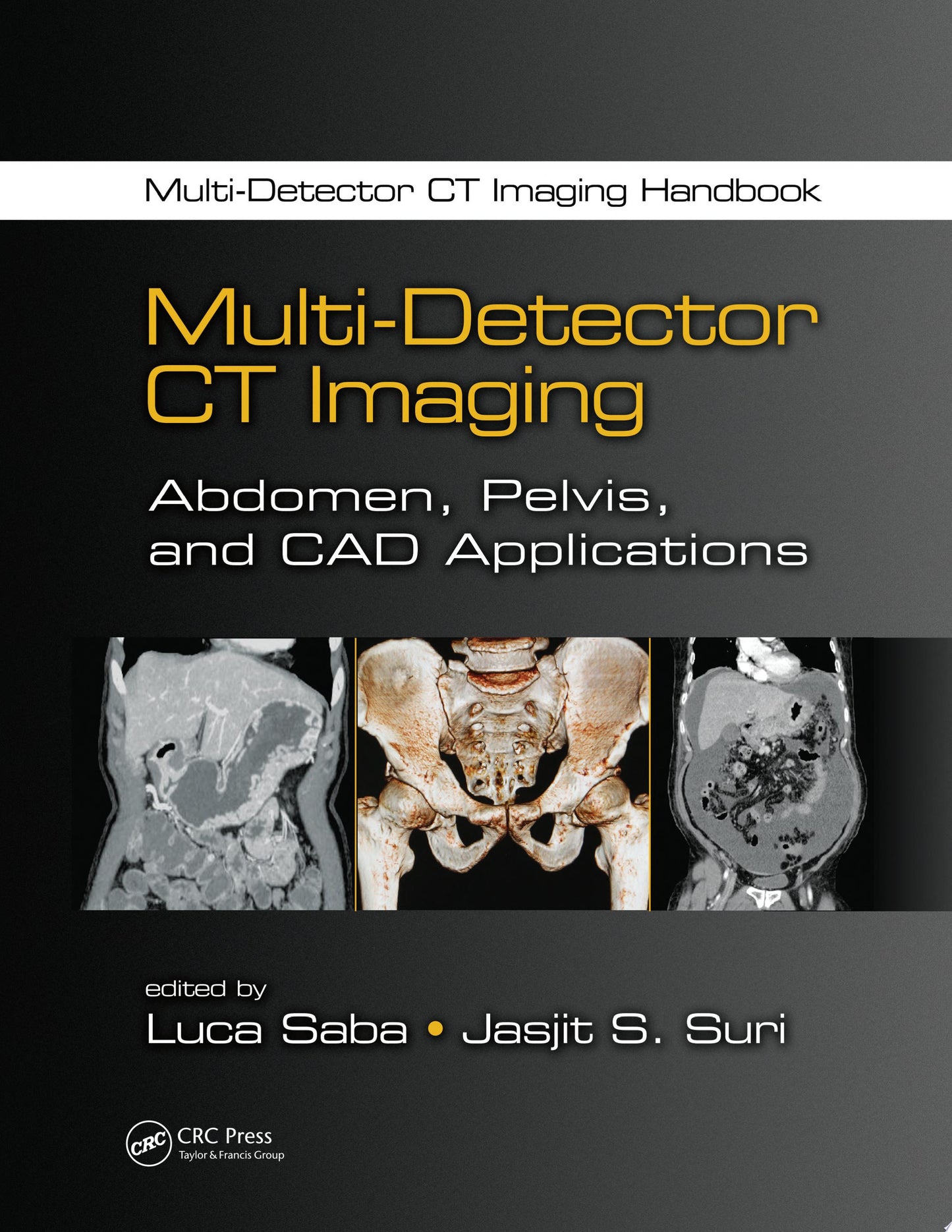 Multi-Detector CT Imaging: Abdomen, Pelvis, and CAD Applications