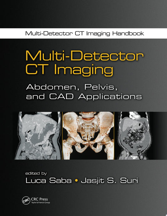 Multi-Detector CT Imaging: Abdomen, Pelvis, and CAD Applications