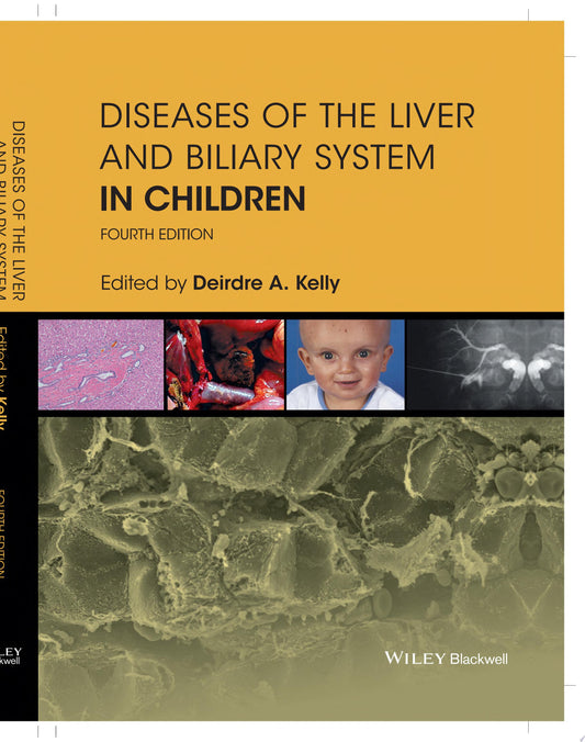 Diseases of the Liver and Biliary System in Children, 4th Edition